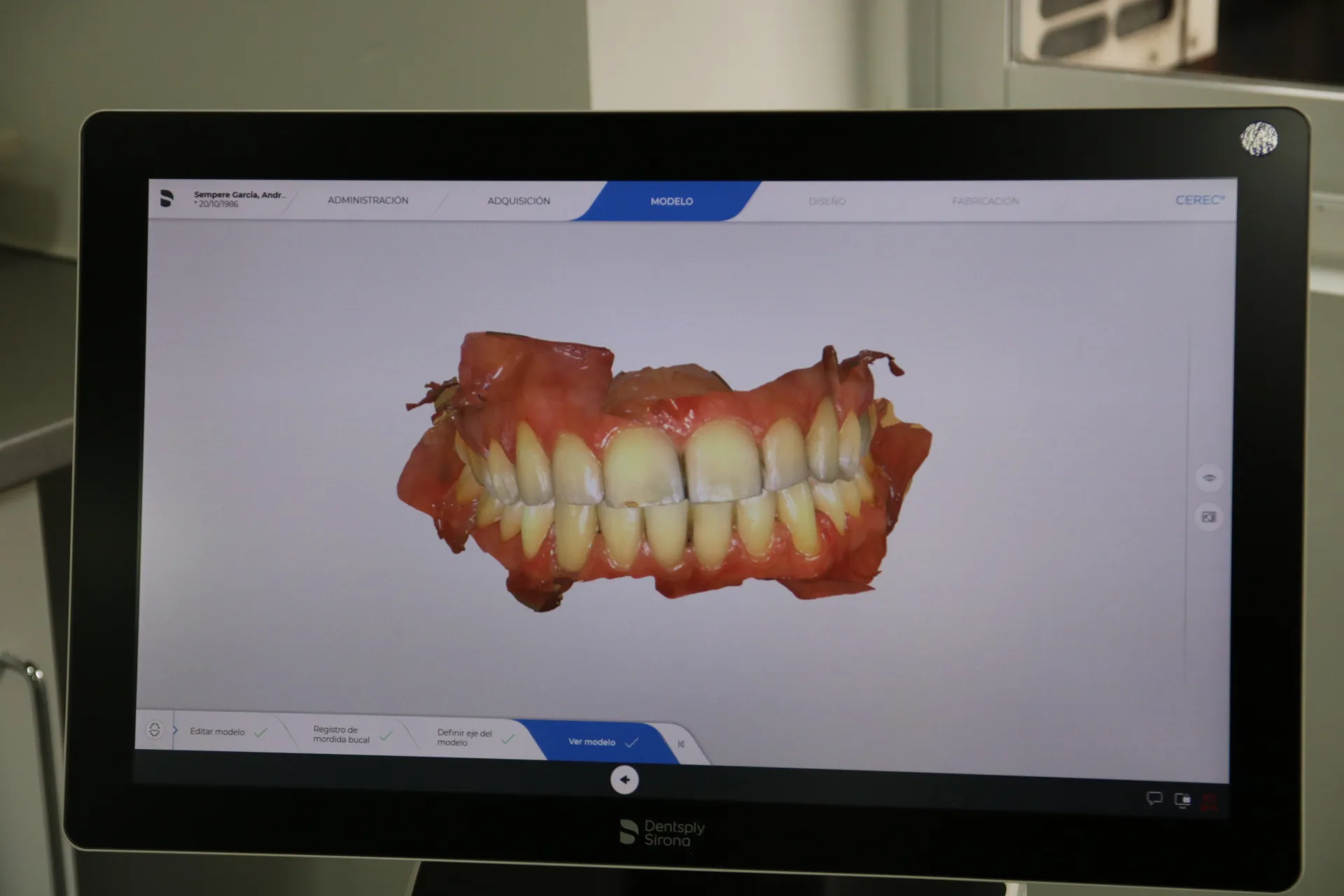 Instrumental de endodoncia avanzada en PerioMax Clínica Dental Alicante