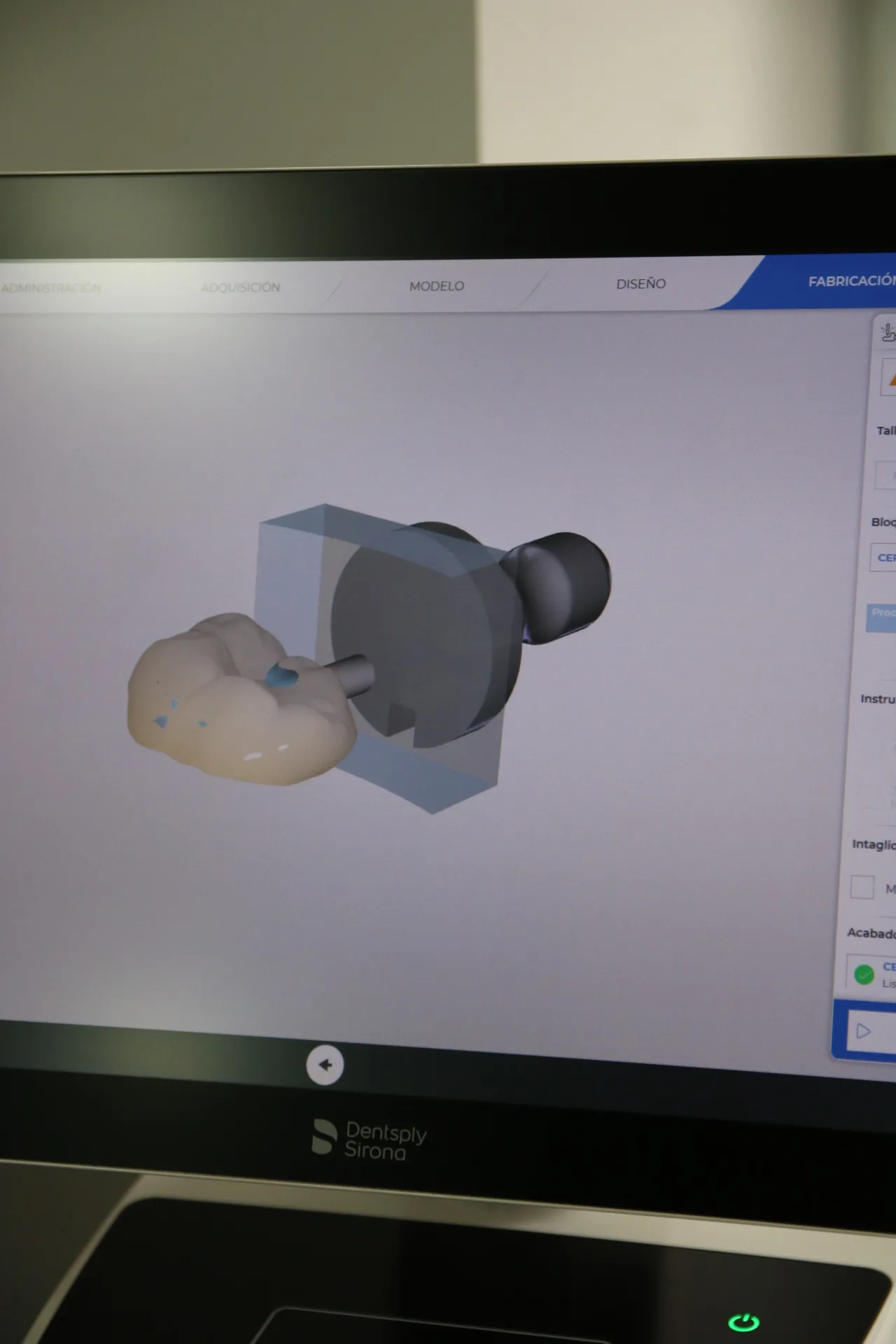 Diseño digital de prótesis con sistema CEREC para carga inmediata en PerioMax