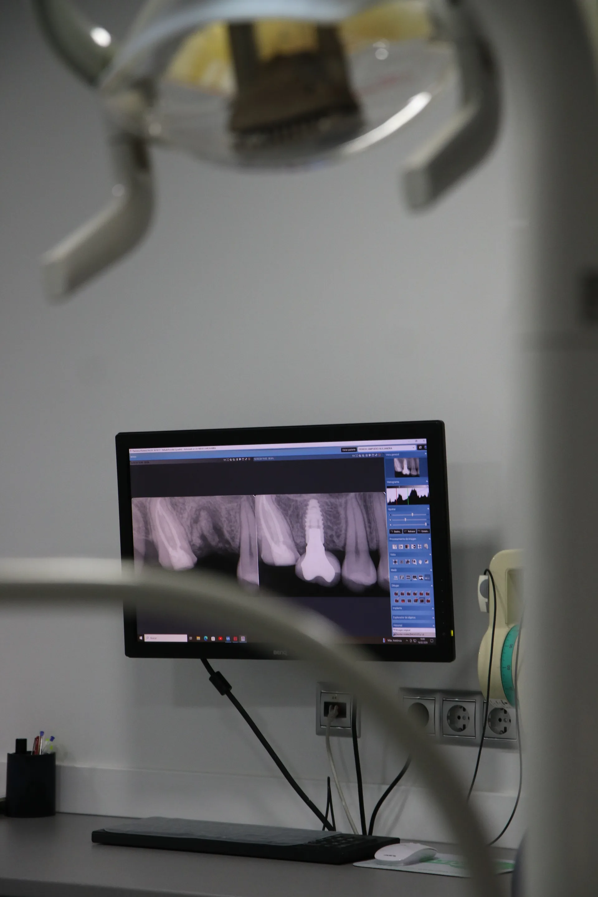 Gabinete de higiene dental con equipo GBT en PerioMax Alicante